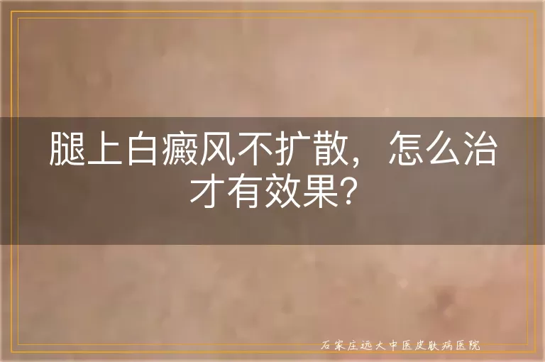腿上白癜风不扩散，怎么治才有效果？