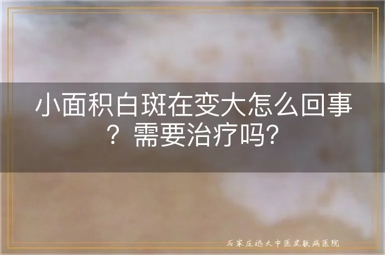 小面积白斑在变大怎么回事？需要治疗吗？