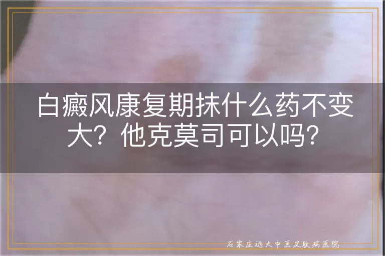 白癜风康复期抹什么药不变大？他克莫司可以吗？