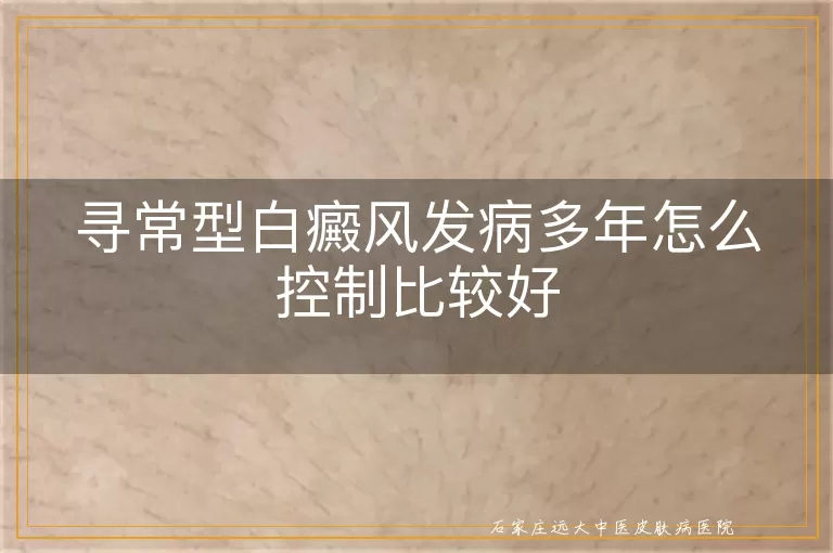 寻常型白癜风发病多年怎么控制比较好