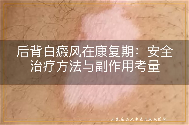 后背白癜风在康复期：安全治疗方法与副作用考量
