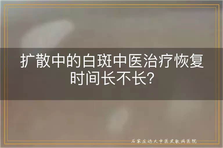 扩散中的白斑中医治疗恢复时间长不长？