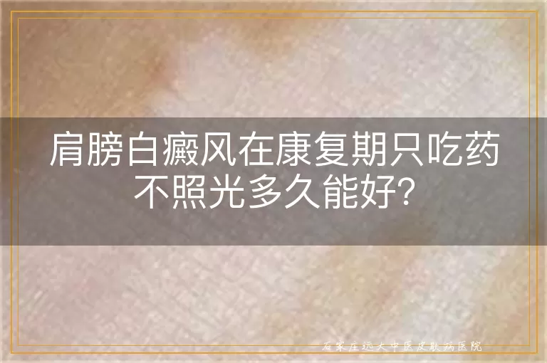 肩膀白癜风在康复期只吃药不照光多久能好？