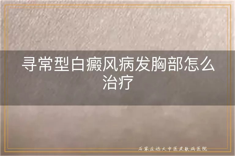 寻常型白癜风病发胸部怎么治疗