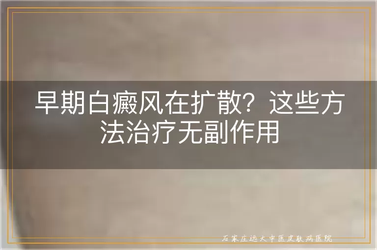 早期白癜风在扩散？这些方法治疗无副作用