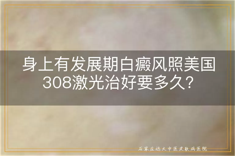 身上有发展期白癜风照美国308激光治好要多久？