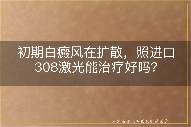 初期白癜风在扩散，照进口308激光能治疗好吗？