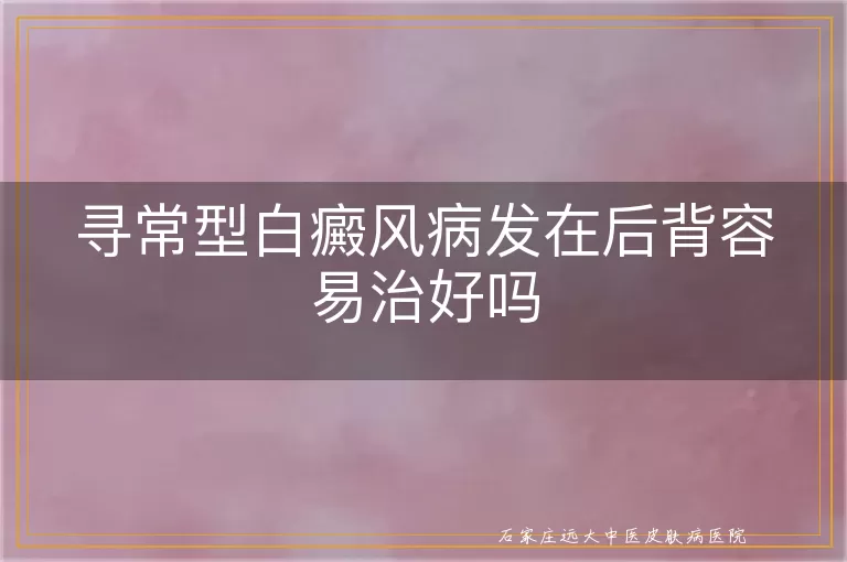 寻常型白癜风病发在后背容易治好吗