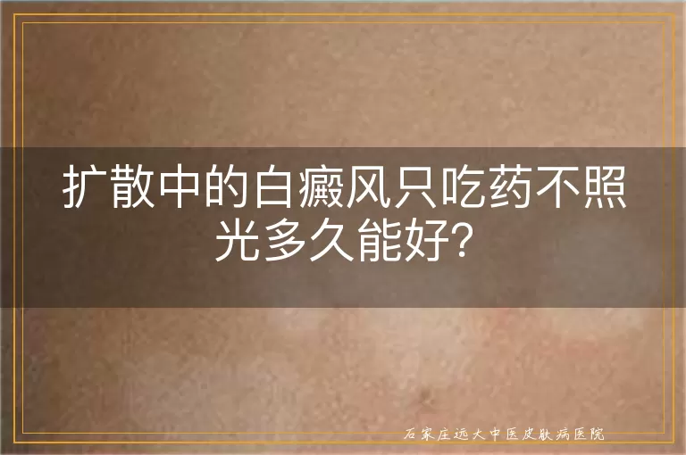 扩散中的白癜风只吃药不照光多久能好？