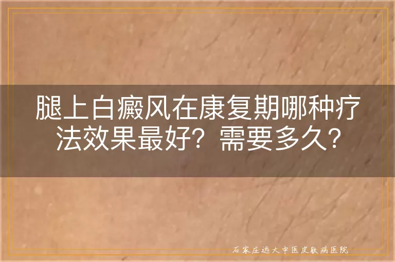 腿上白癜风在康复期哪种疗法效果最好？需要多久？