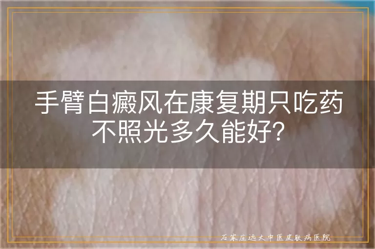 手臂白癜风在康复期只吃药不照光多久能好？