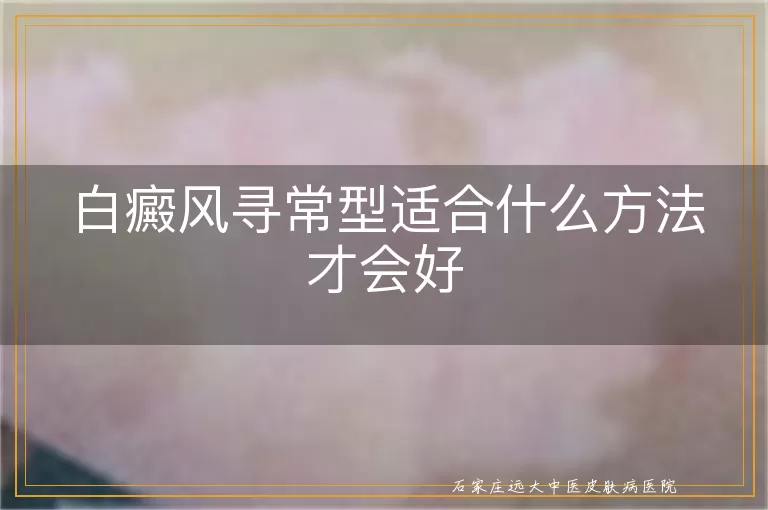白癜风寻常型适合什么方法才会好