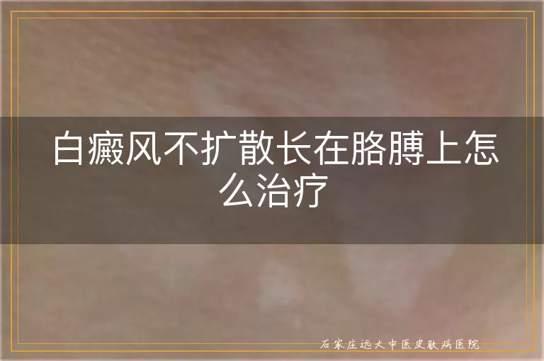 白癜风不扩散长在胳膊上怎么治疗