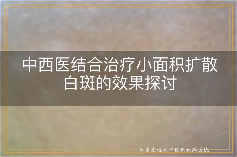 中西医结合治疗小面积扩散白斑的效果探讨