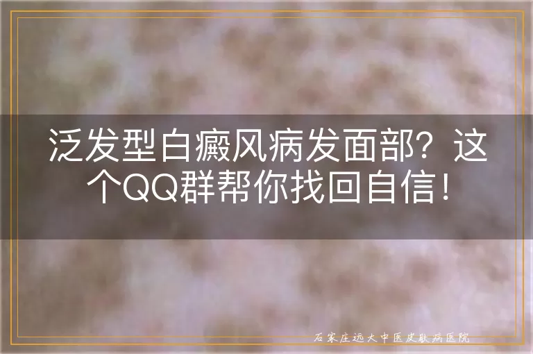泛发型白癜风病发面部？这个QQ群帮你找回自信！
