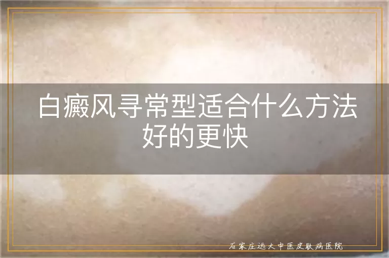 白癜风寻常型适合什么方法好的更快