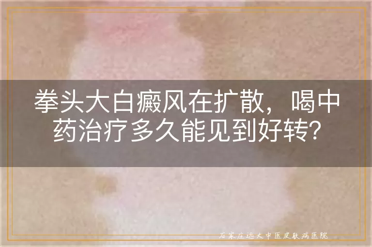 拳头大白癜风在扩散，喝中药治疗多久能见到好转？