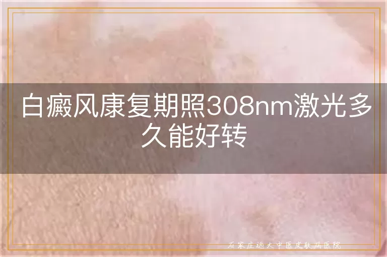 白癜风康复期照308nm激光多久能好转