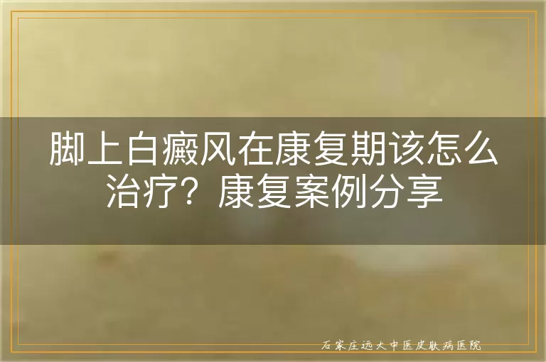 脚上白癜风在康复期该怎么治疗？康复案例分享