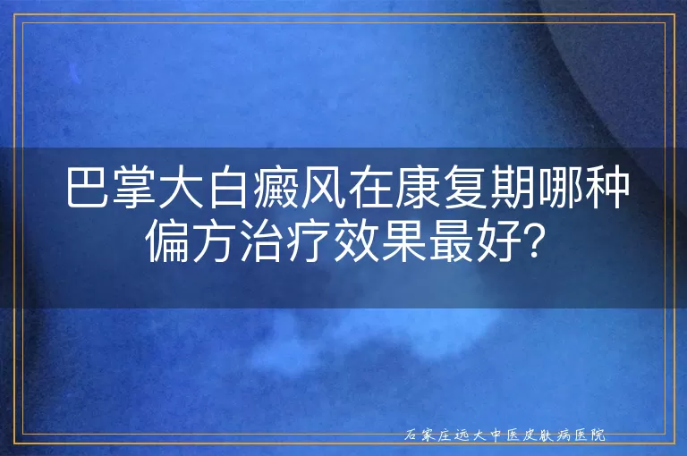 巴掌大白癜风在康复期哪种偏方治疗效果最好？