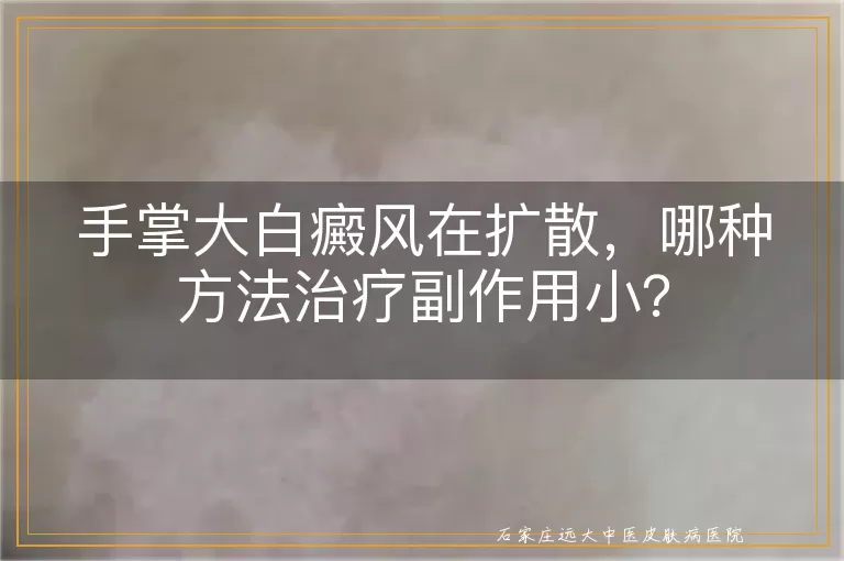 手掌大白癜风在扩散，哪种方法治疗副作用小？