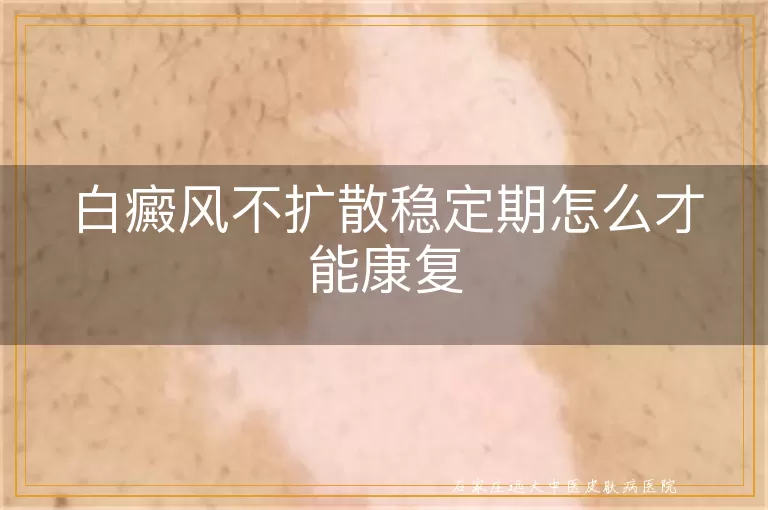 白癜风不扩散稳定期怎么才能康复