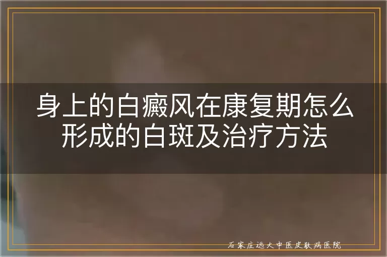 身上的白癜风在康复期怎么形成的白斑及治疗方法
