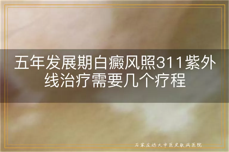五年发展期白癜风照311紫外线治疗需要几个疗程