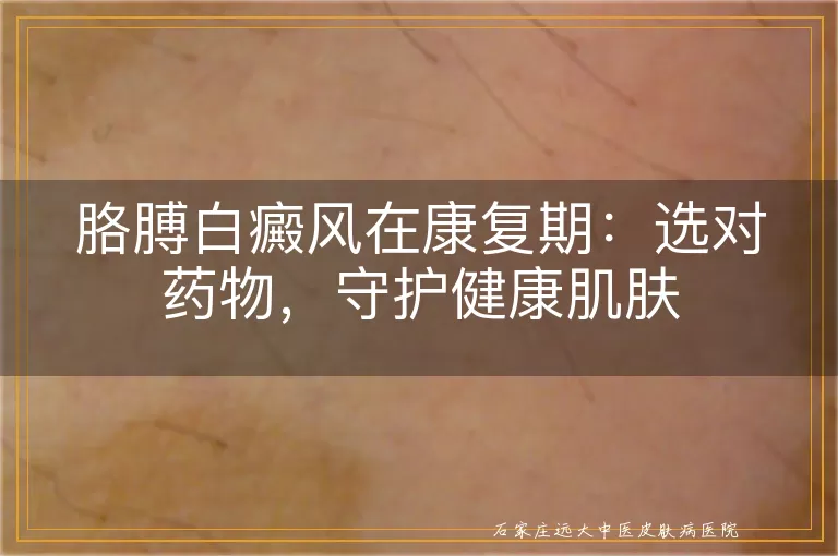 胳膊白癜风在康复期：选对药物，守护健康肌肤