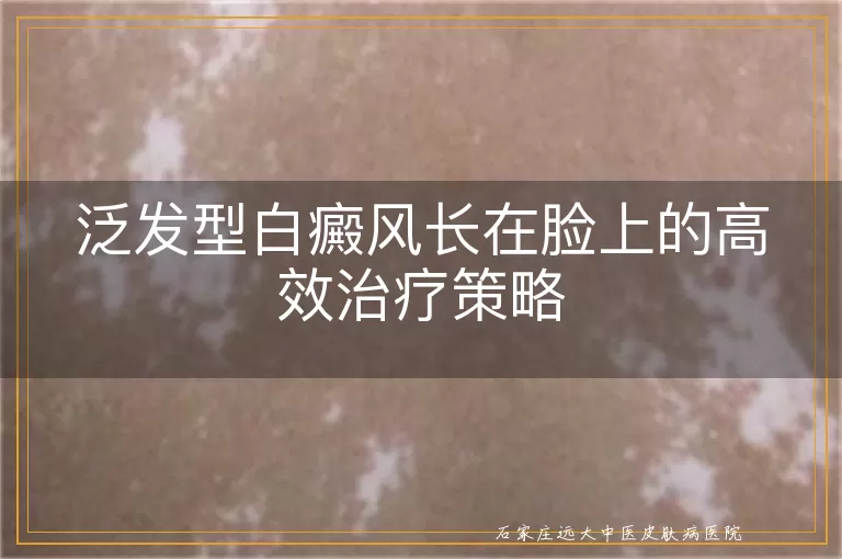 泛发型白癜风长在脸上的高效治疗策略