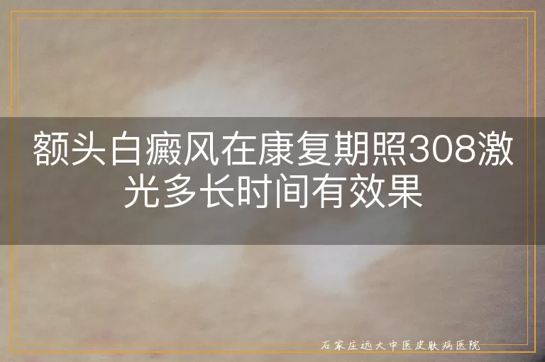 额头白癜风在康复期照308激光多长时间有效果