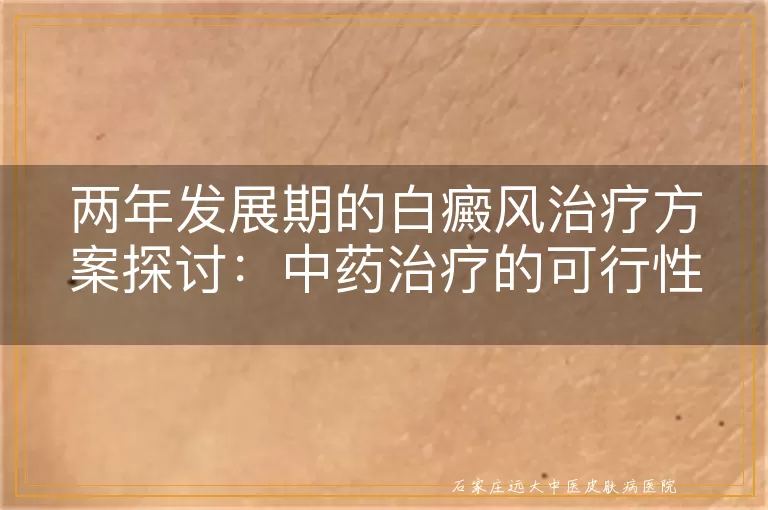 两年发展期的白癜风治疗方案探讨：中药治疗的可行性与优势