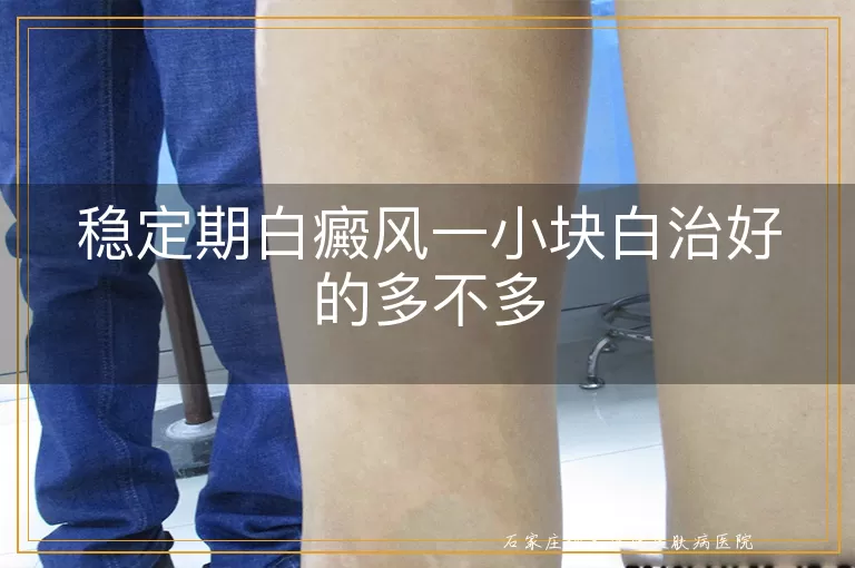 稳定期白癜风一小块白治好的多不多
