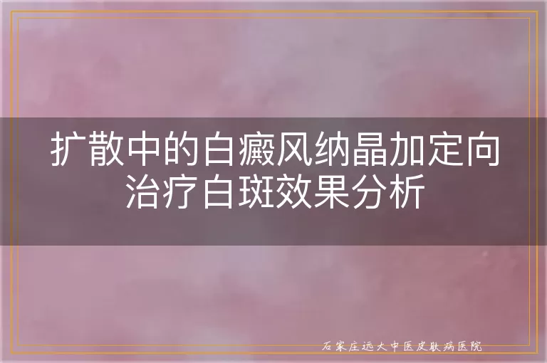 扩散中的白癜风纳晶加定向治疗白斑效果分析
