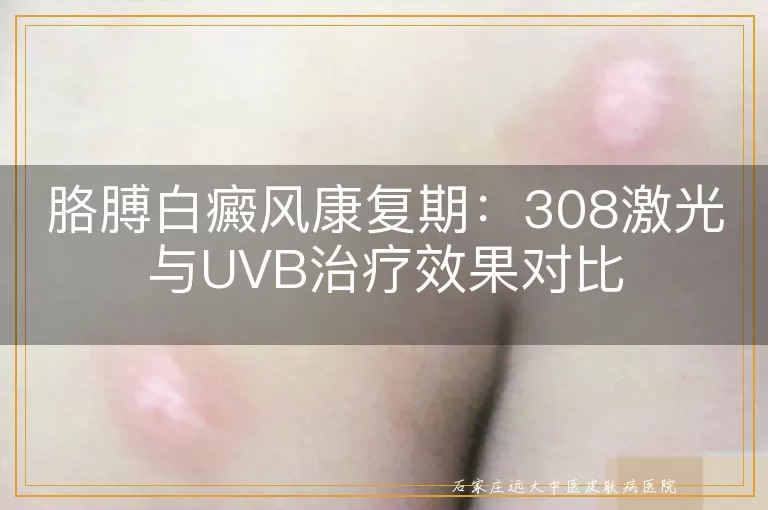 胳膊白癜风康复期：308激光与UVB治疗效果对比