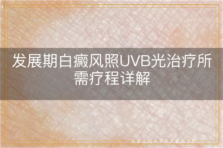 发展期白癜风照UVB光治疗所需疗程详解