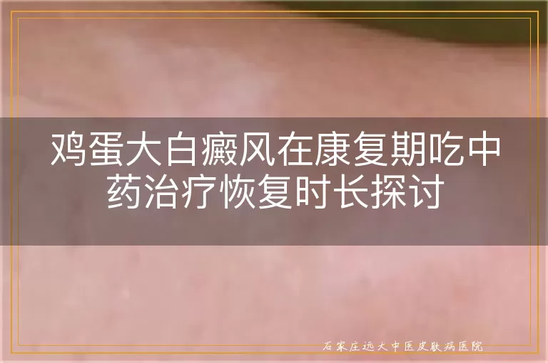 鸡蛋大白癜风在康复期吃中药治疗恢复时长探讨
