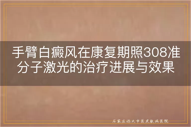 手臂白癜风在康复期照308准分子激光的治疗进展与效果观察