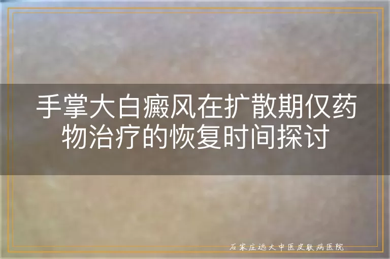 手掌大白癜风在扩散期仅药物治疗的恢复时间探讨