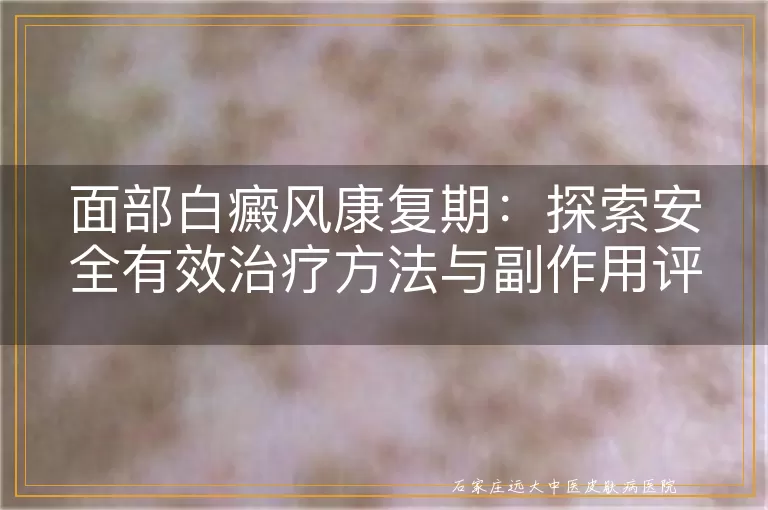 面部白癜风康复期：探索安全有效治疗方法与副作用评估