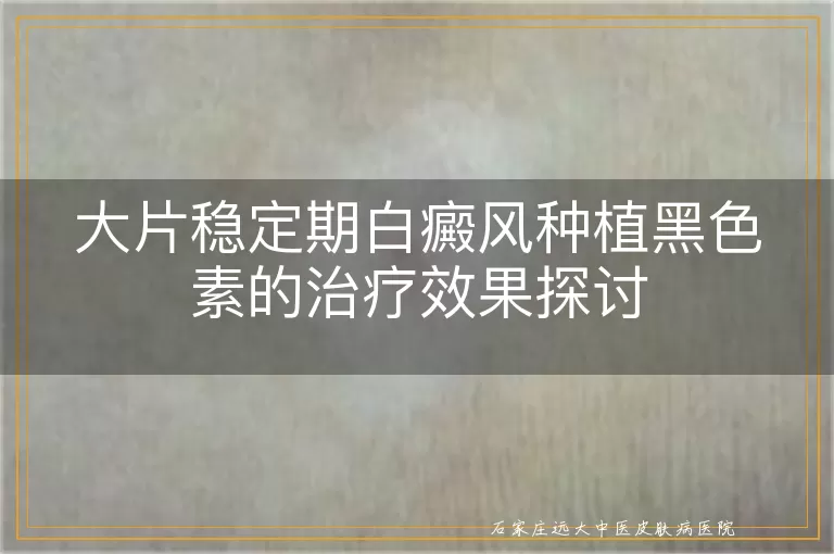 大片稳定期白癜风种植黑色素的治疗效果探讨