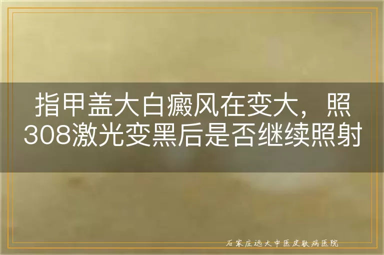 指甲盖大白癜风在变大，照308激光变黑后是否继续照射？