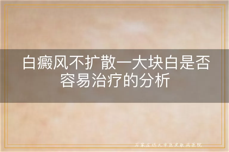 白癜风不扩散一大块白是否容易治疗的分析