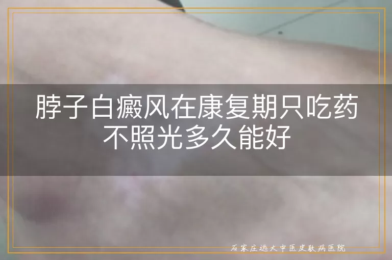 脖子白癜风在康复期只吃药不照光多久能好