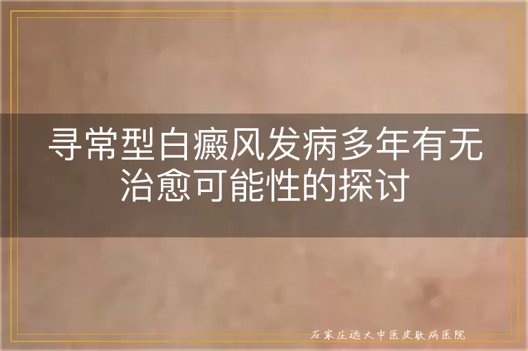 寻常型白癜风发病多年有无治愈可能性的探讨