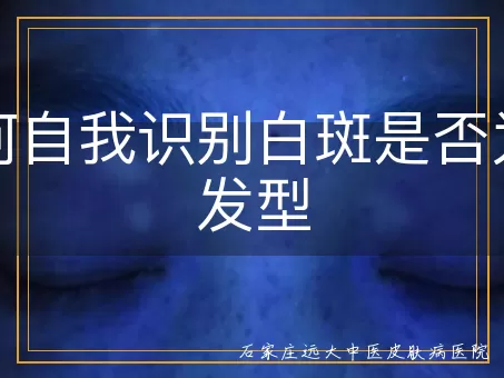 如何自我识别白斑是否为泛发型