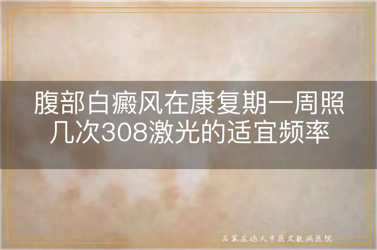 腹部白癜风在康复期一周照几次308激光的适宜频率