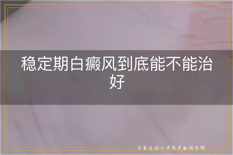 稳定期白癜风到底能不能治好