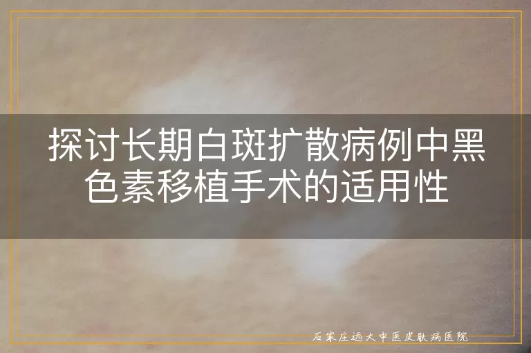 探讨长期白斑扩散病例中黑色素移植手术的适用性