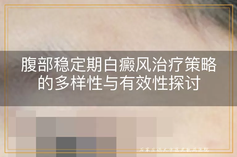 腹部稳定期白癜风治疗策略的多样性与有效性探讨